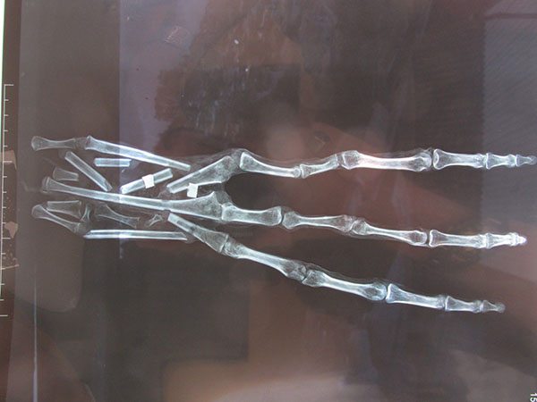 x-ray alien hand